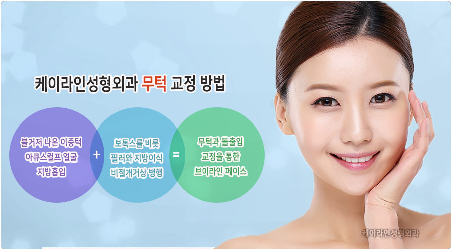 무턱 교정 방법