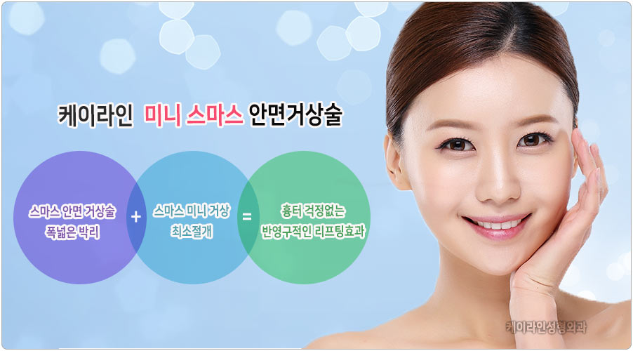 미니 스마스 안면거상술