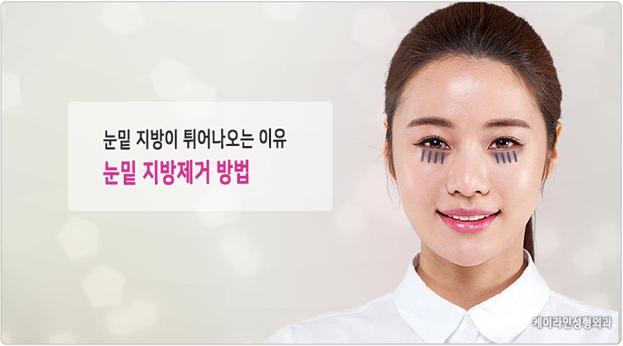 튀어나온 눈밑 지방 제거 방법