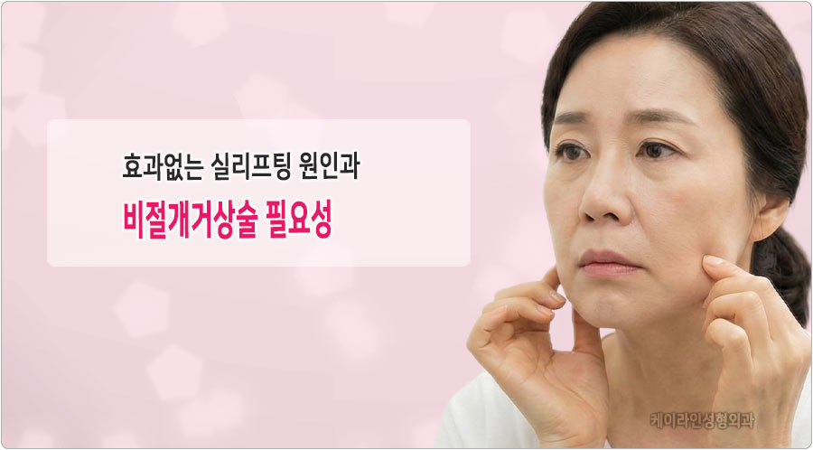 효과없는 실리프팅