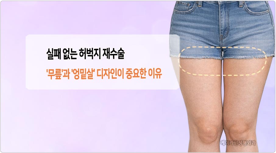 허벅지 지방흡입 재수술 필요성