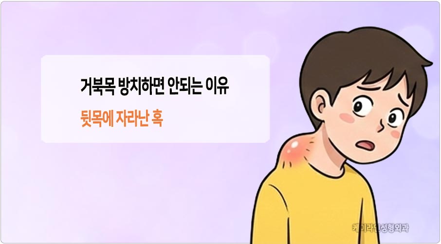 거북목 방치하면 안되는 이유