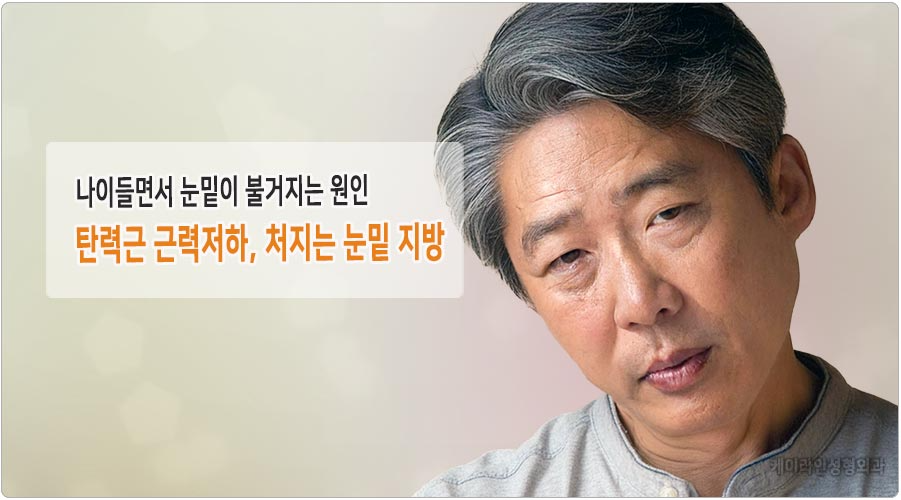 눈밑 불거짐 원인