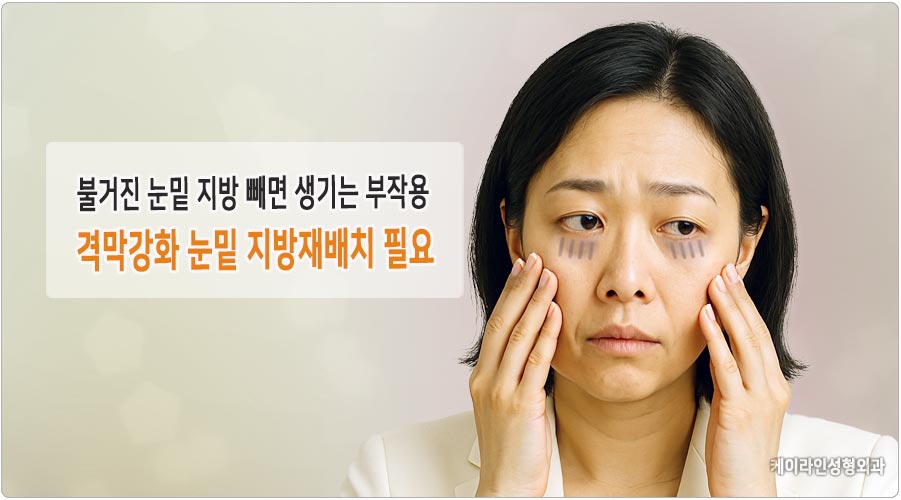 눈밑 지방제거 부작용 줄이는 눈밑 지방재배치