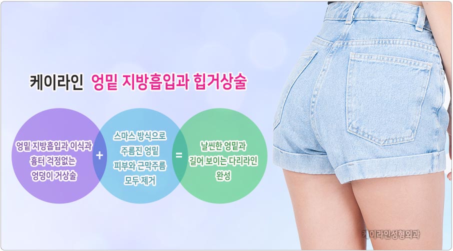 바나나폴드 제거