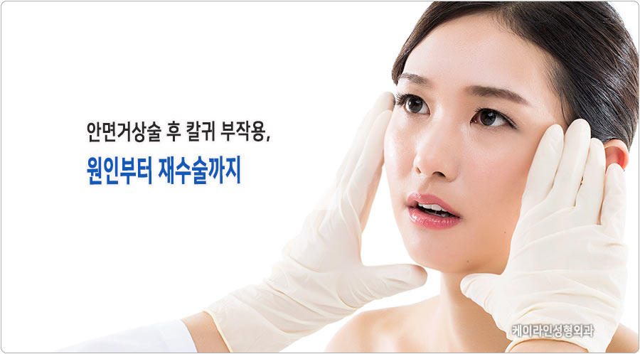 안면거상술 칼귀 원인