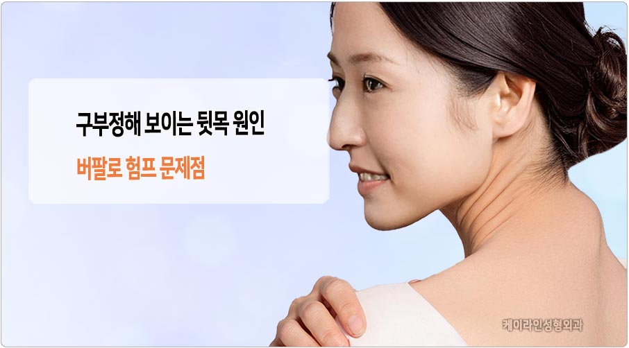 구부정한 뒷목 버팔로 험프 지방흡입 필요성