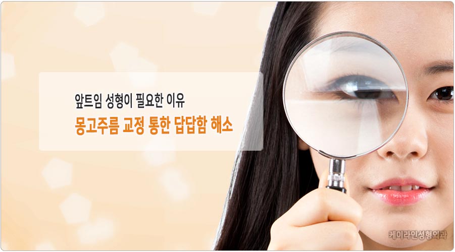 앞트임 성형 필요성