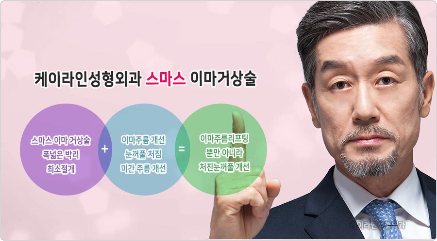 스마스 이마거상술