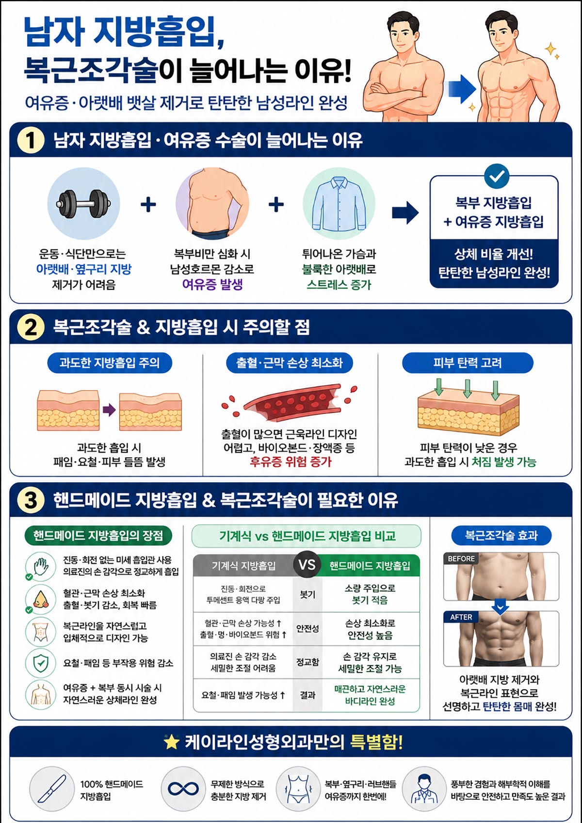 여유증과 지방흡입, 복근 조각술 방법
