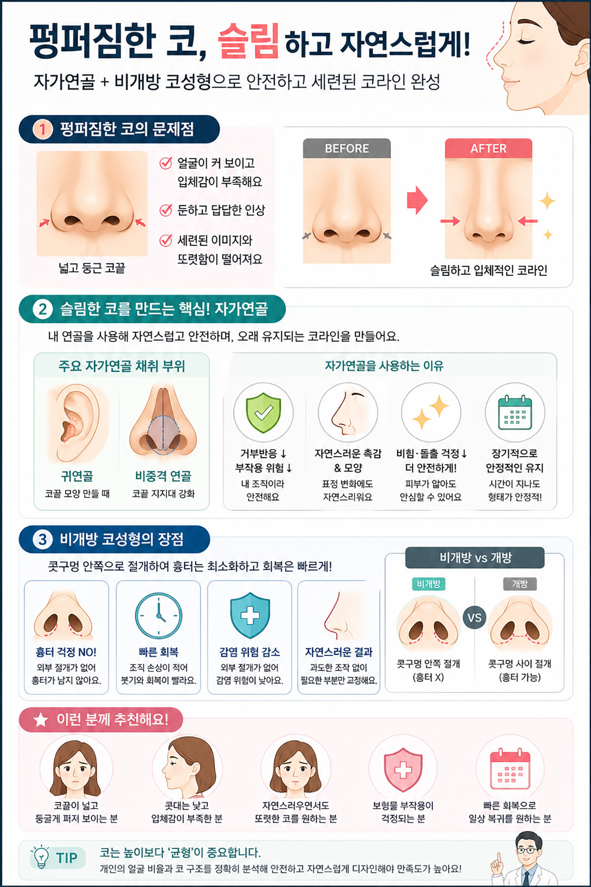 자가연골 코 수술과 비개방 수술 특징