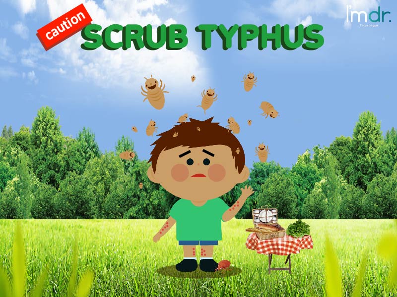 SCRUB TYPHUS - Symptoms, prevention and treatment : Imdr.