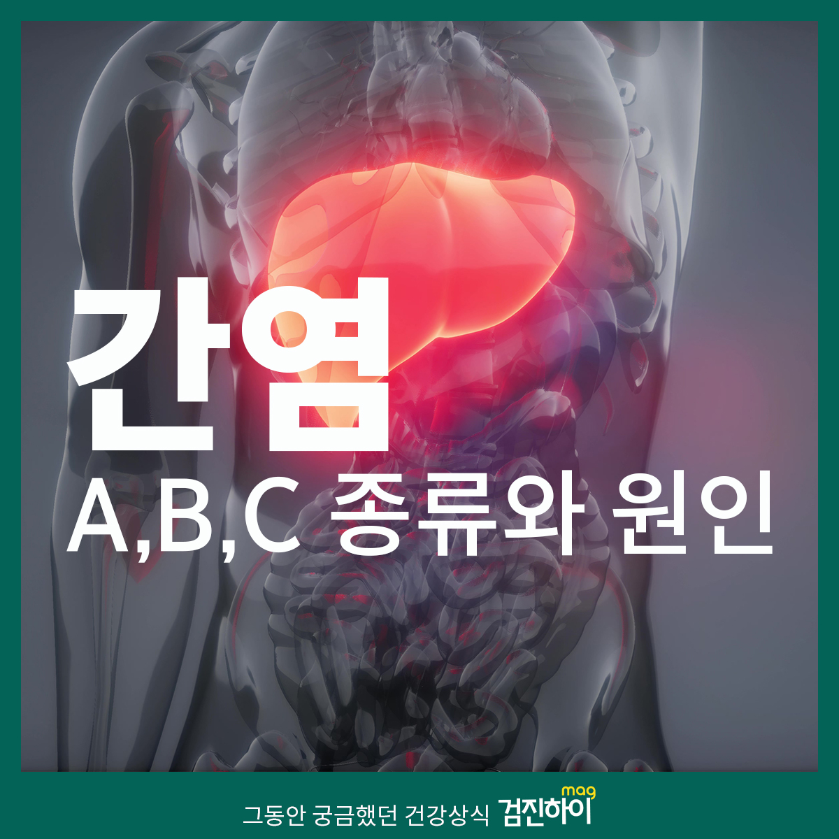 간염 A,B,C 종류와 원인 : 건강검진정보