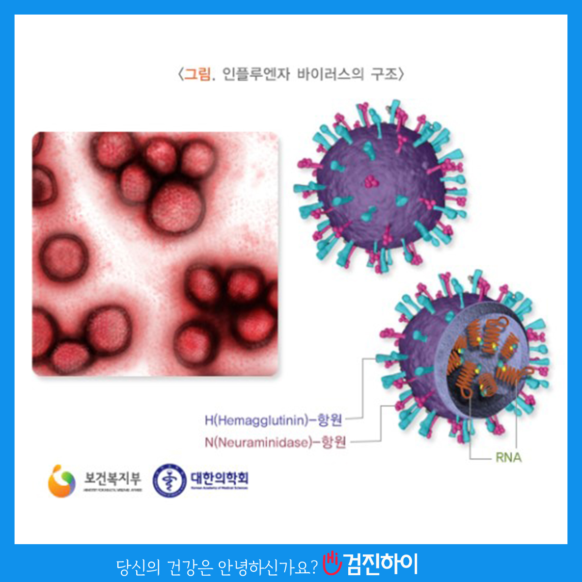 인플루엔자 / 감기와 다른 점은? : 건강검진정보