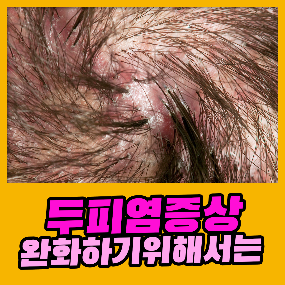 4d83e64218309.jpg