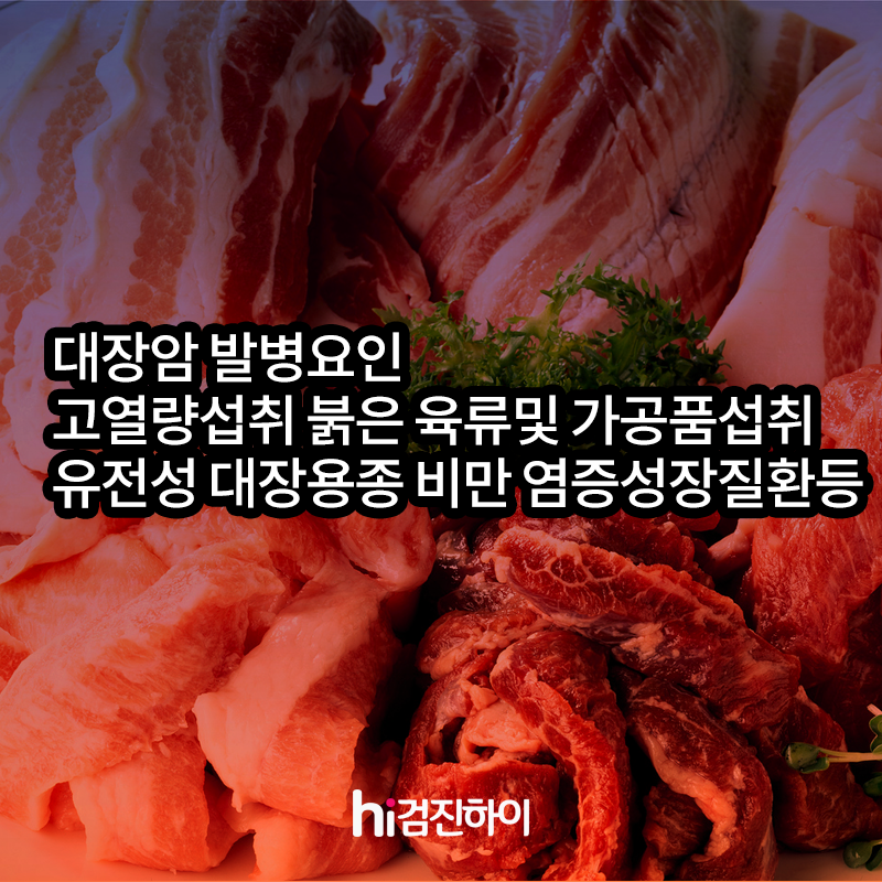 5대암 국가검진 중 대장암에 대해 알아보기 : 건강검진정보