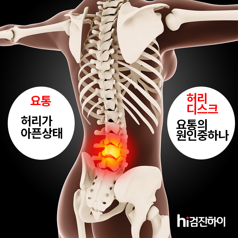 요통과 허리 디스크는 같아? 달라? : 건강검진정보