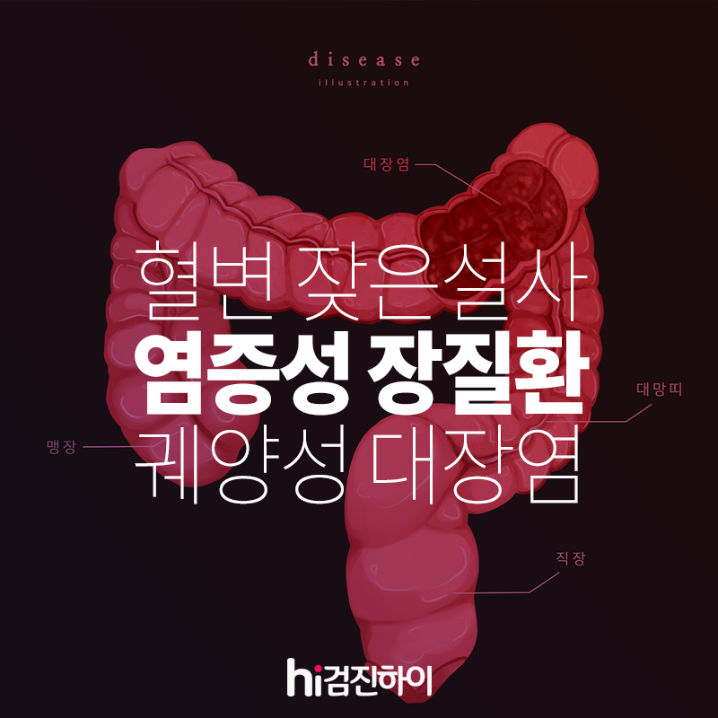 혈변 잦은 설사 복통 염증성 장질환, 궤양성 대장염은 무엇? : 건강검진정보