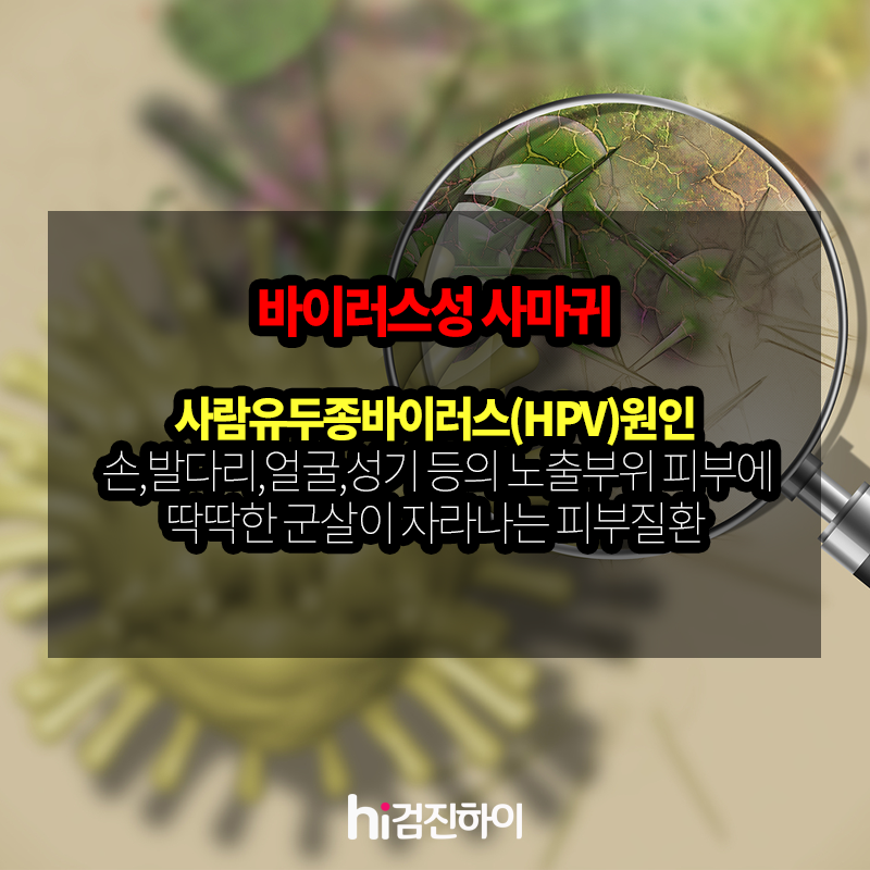 5c1336b33eaf8.png