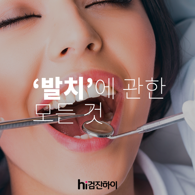 치과치료에 빈번하게 시행되는 '발치'에 관한 모든 것 : 건강검진정보