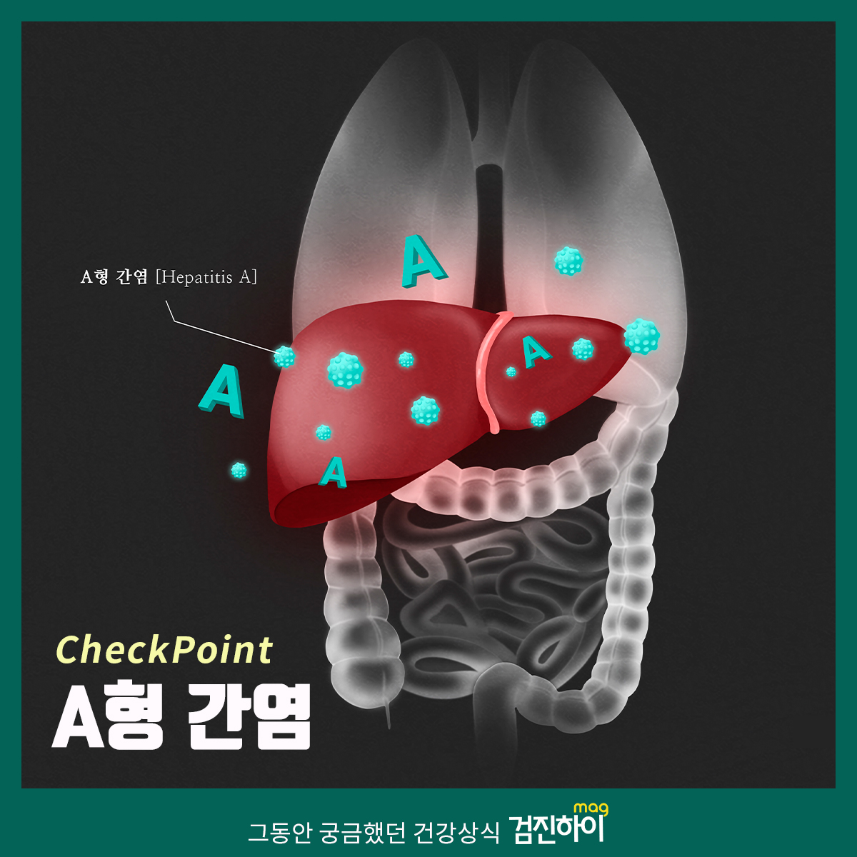 간염 A,B,C 종류와 원인 : 건강검진정보