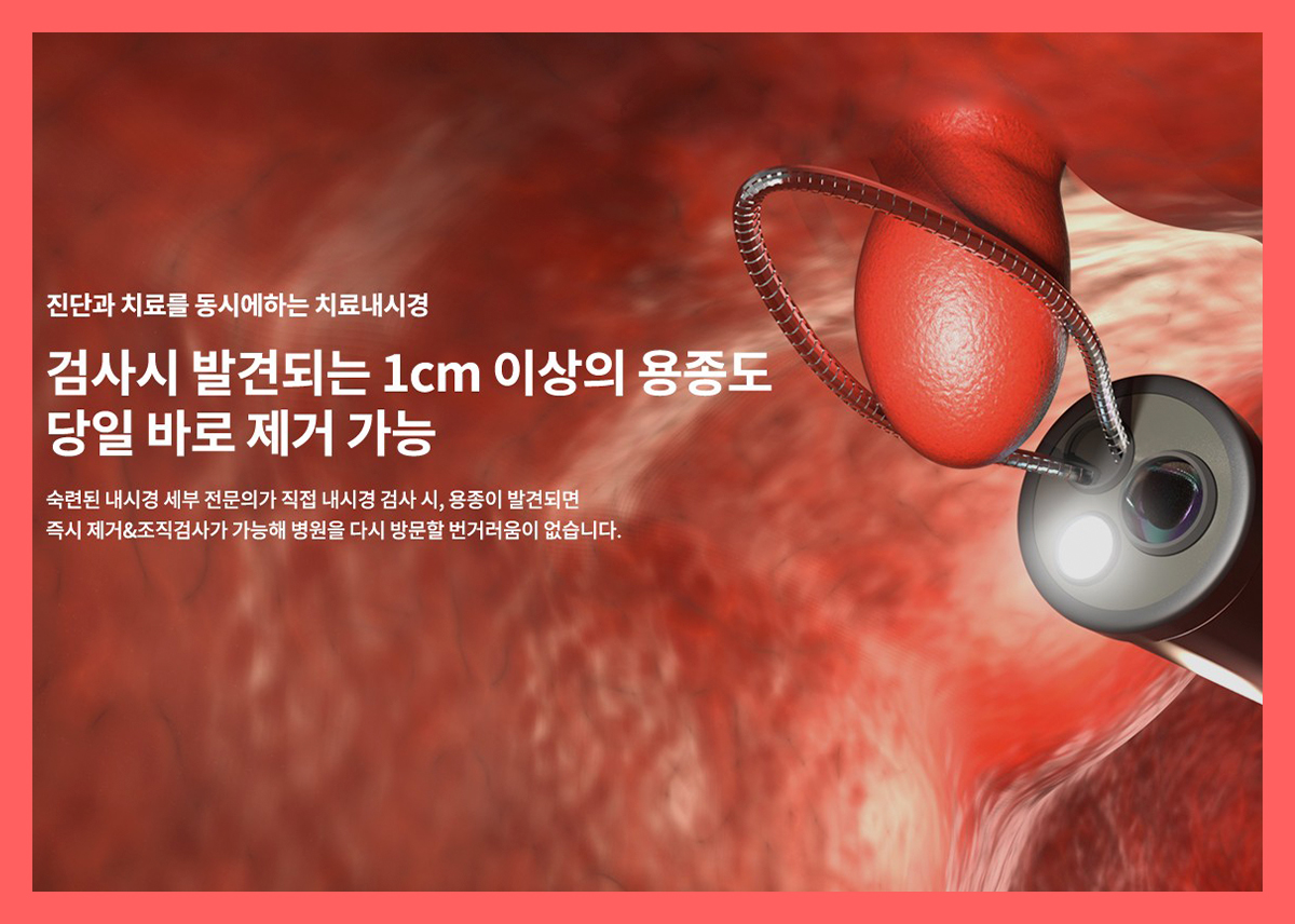 송파 종합 건강검진센터 / 서울병원, 귀찮고 두려울 수 있는 건강검진이지만 : 건강검진정보
