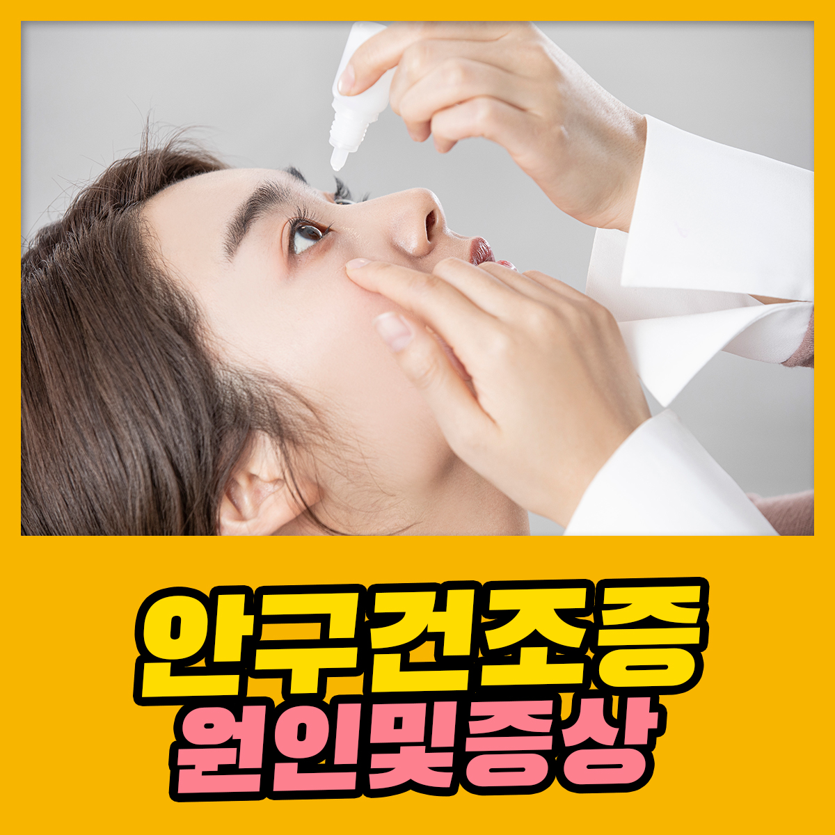 안구건조증의 원인 및 증상 : 건강검진정보 안구건조증의 원인 및 증상 : 건강검진정보