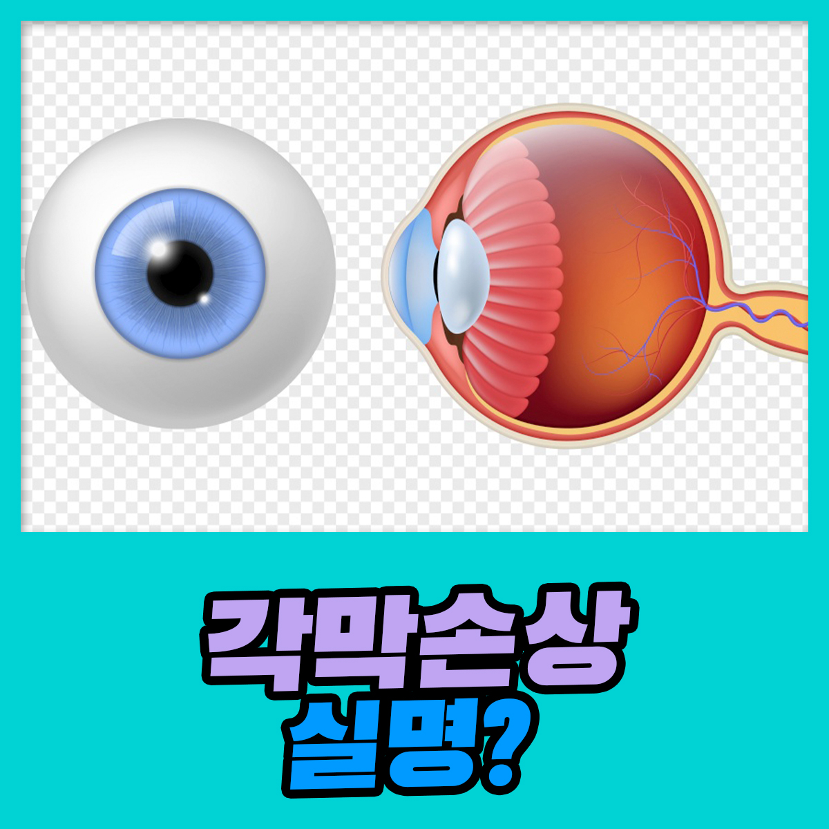 각막이 손상, 자칫 실명으로도 이어질 수 있어 : 건강검진정보
