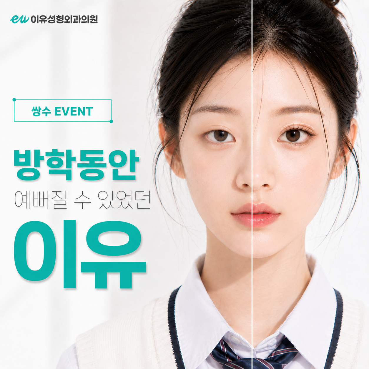 이유성형외과 쌍꺼풀수술 이벤트