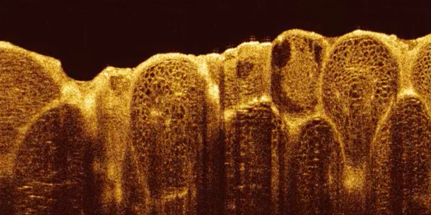 3D image stack of lemon pulp (≈8 x 8 x 4mm).  Click to download video (15MB)