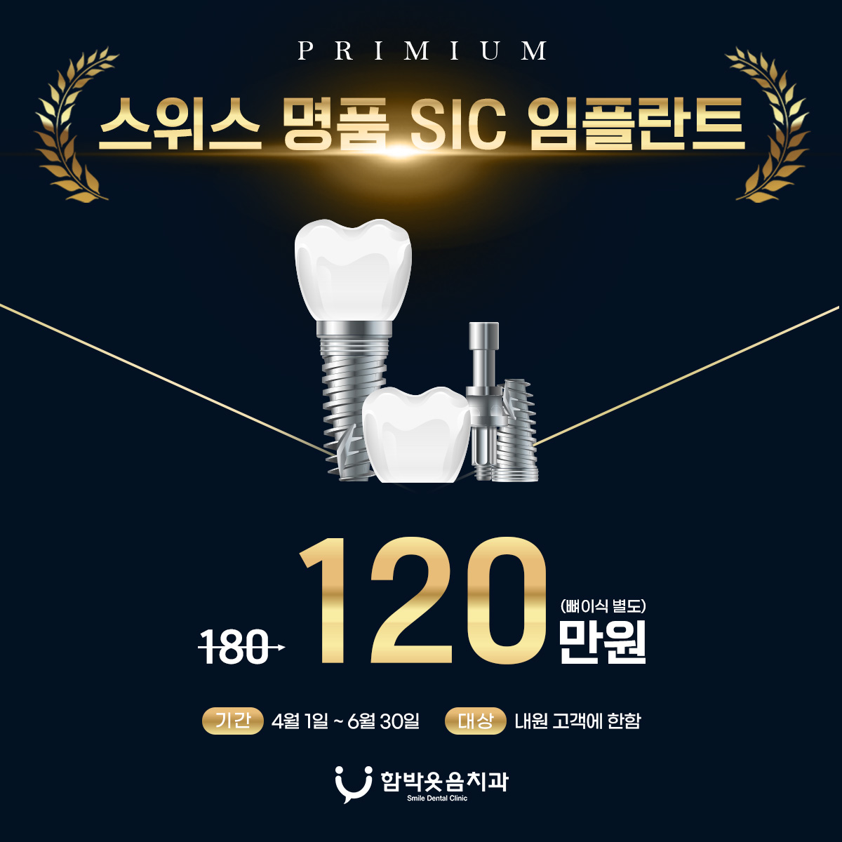 SIC임플란트