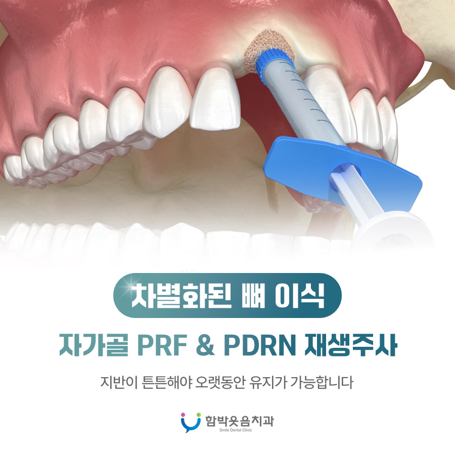 차별화된뼈이식
