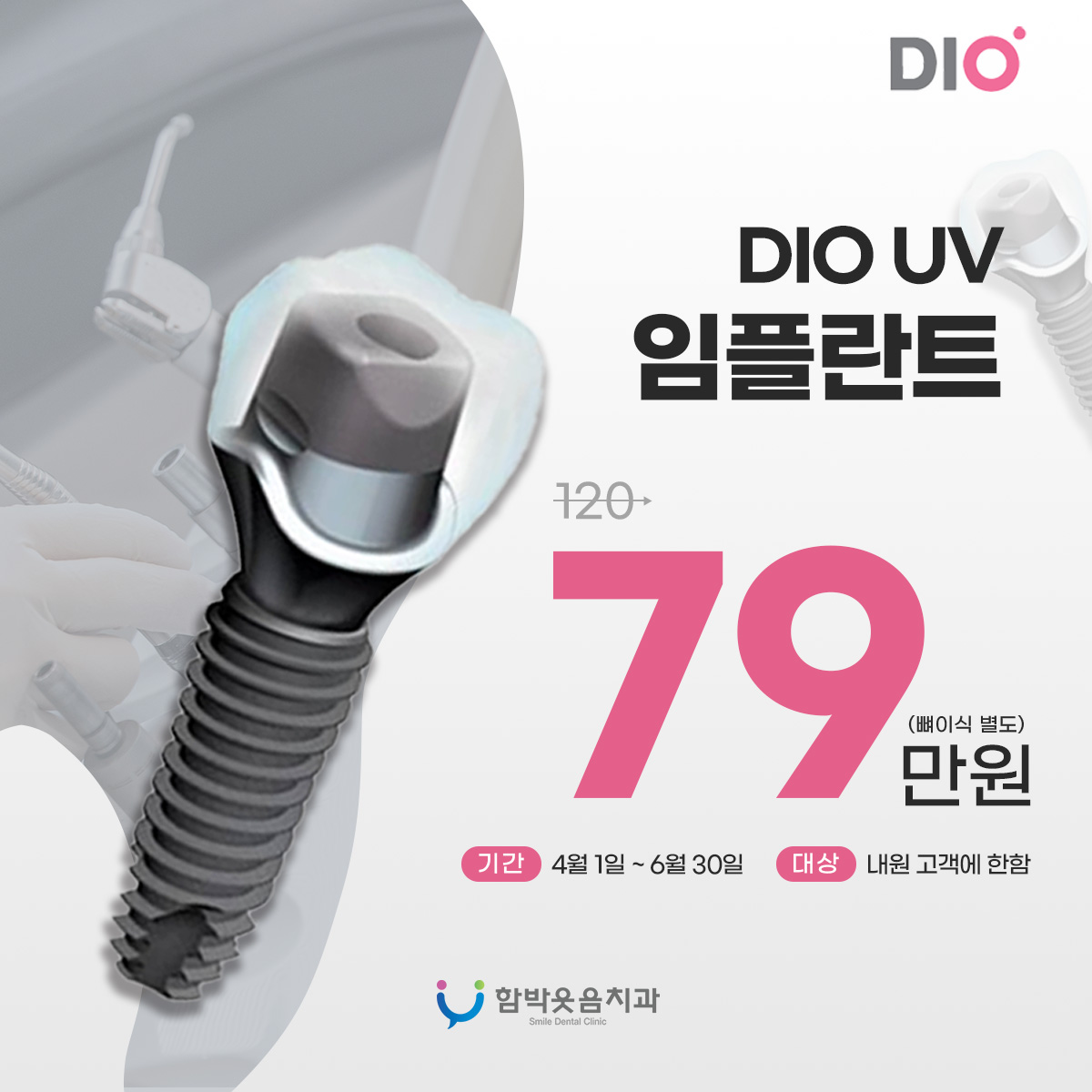 디오임플란트