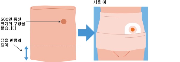 복대 튜브의 사용 예