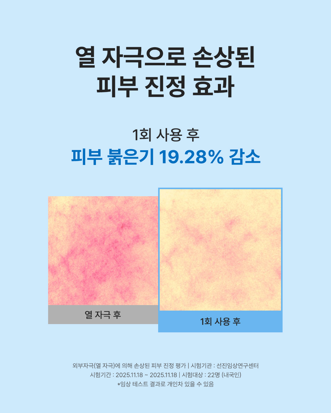 [히알1,000] 히알 수딩 수분 마스크 120ml