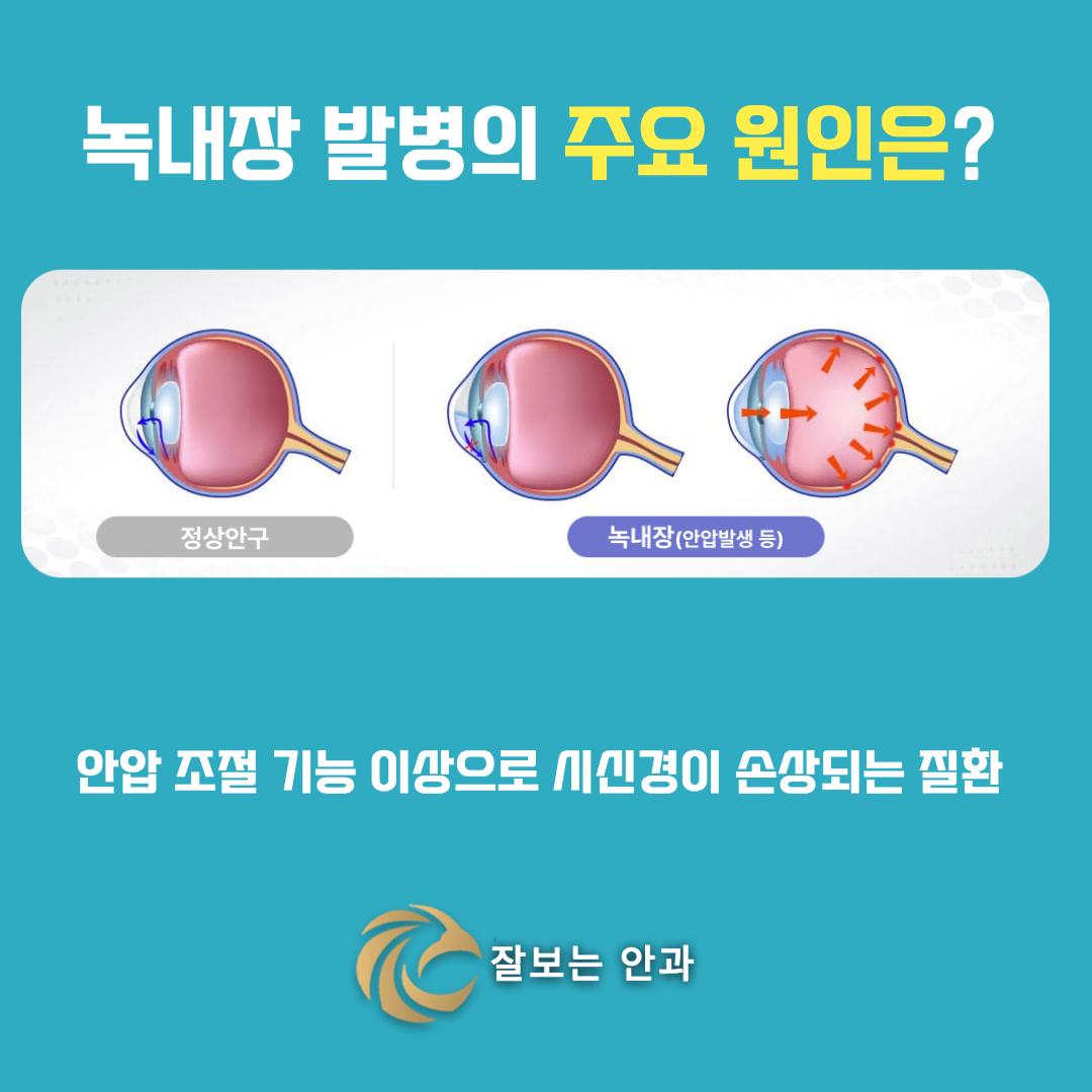 3d1f334f7fd2e.png