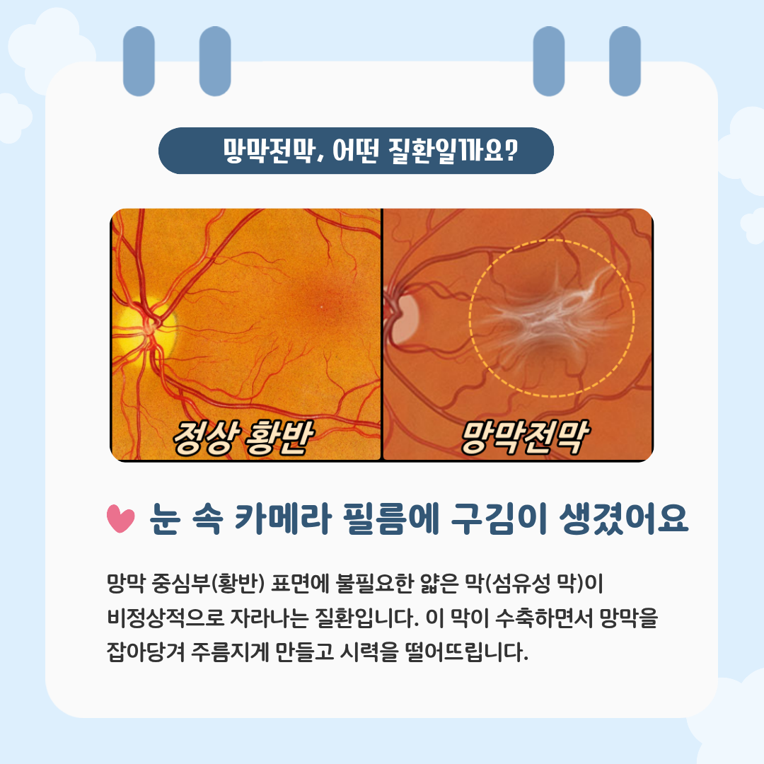 8a514176c2262.png