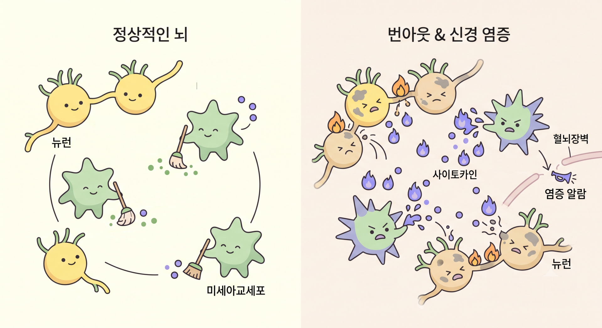 정상적인 뇌와 번아웃이 온 뇌 @nano banana