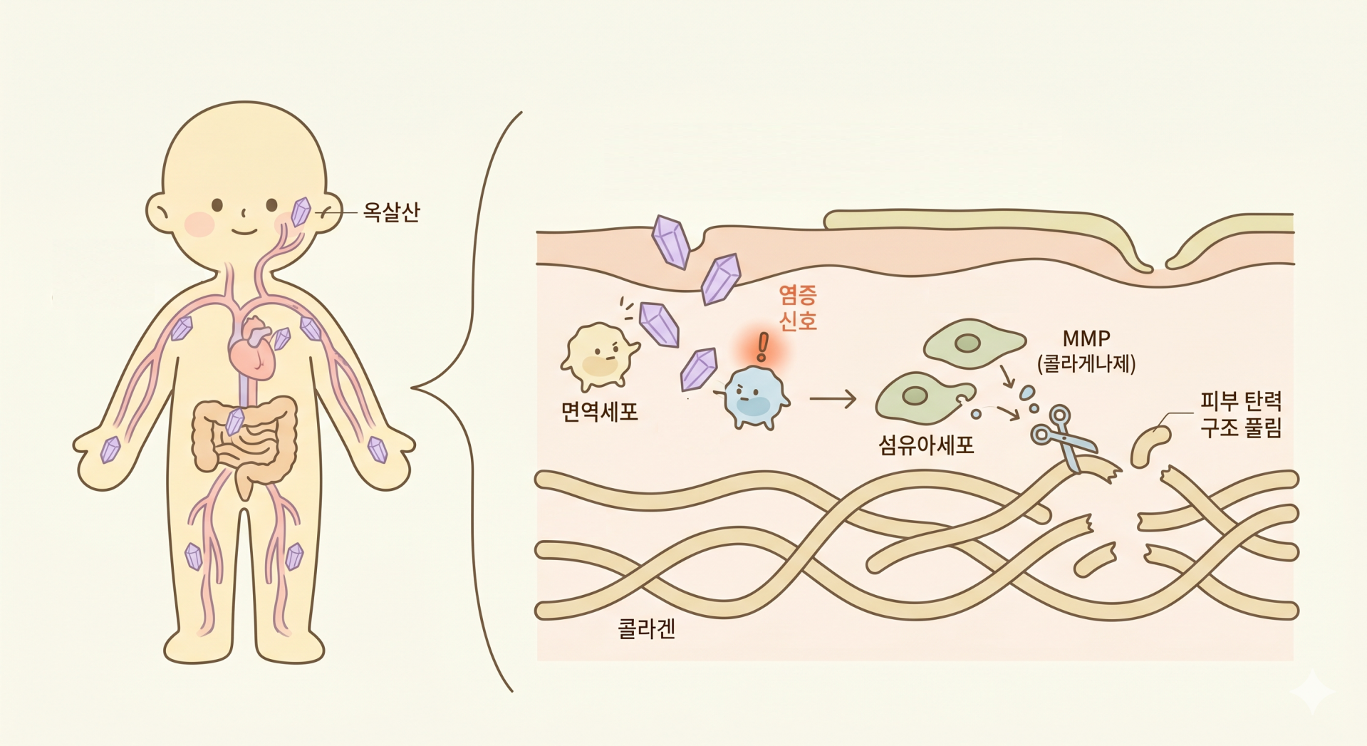 옥살산이 피부를 망가뜨리는 과정 @nano banana.png