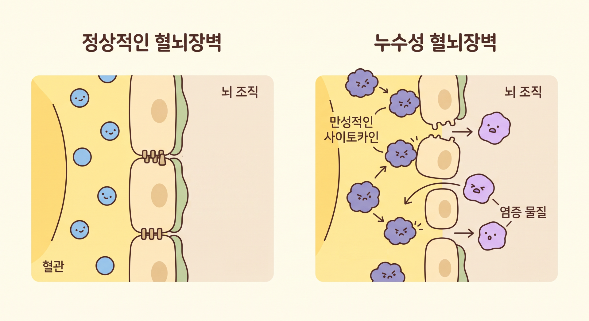 정상적인 혈뇌장벽과 누수성 혈뇌장벽 @nano banana