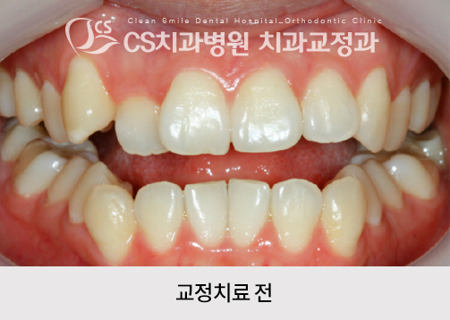 5f3e3bcae90a2.jpg