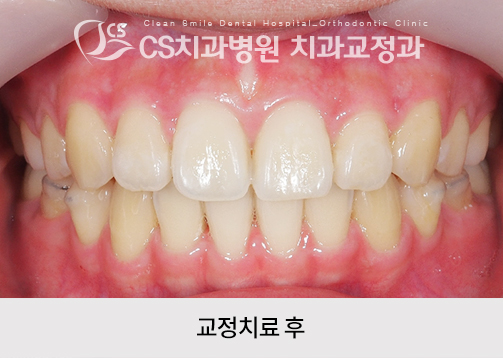 ab76b1f93cf25.jpg