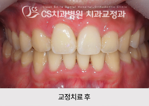 ecca4884d02bd.jpg