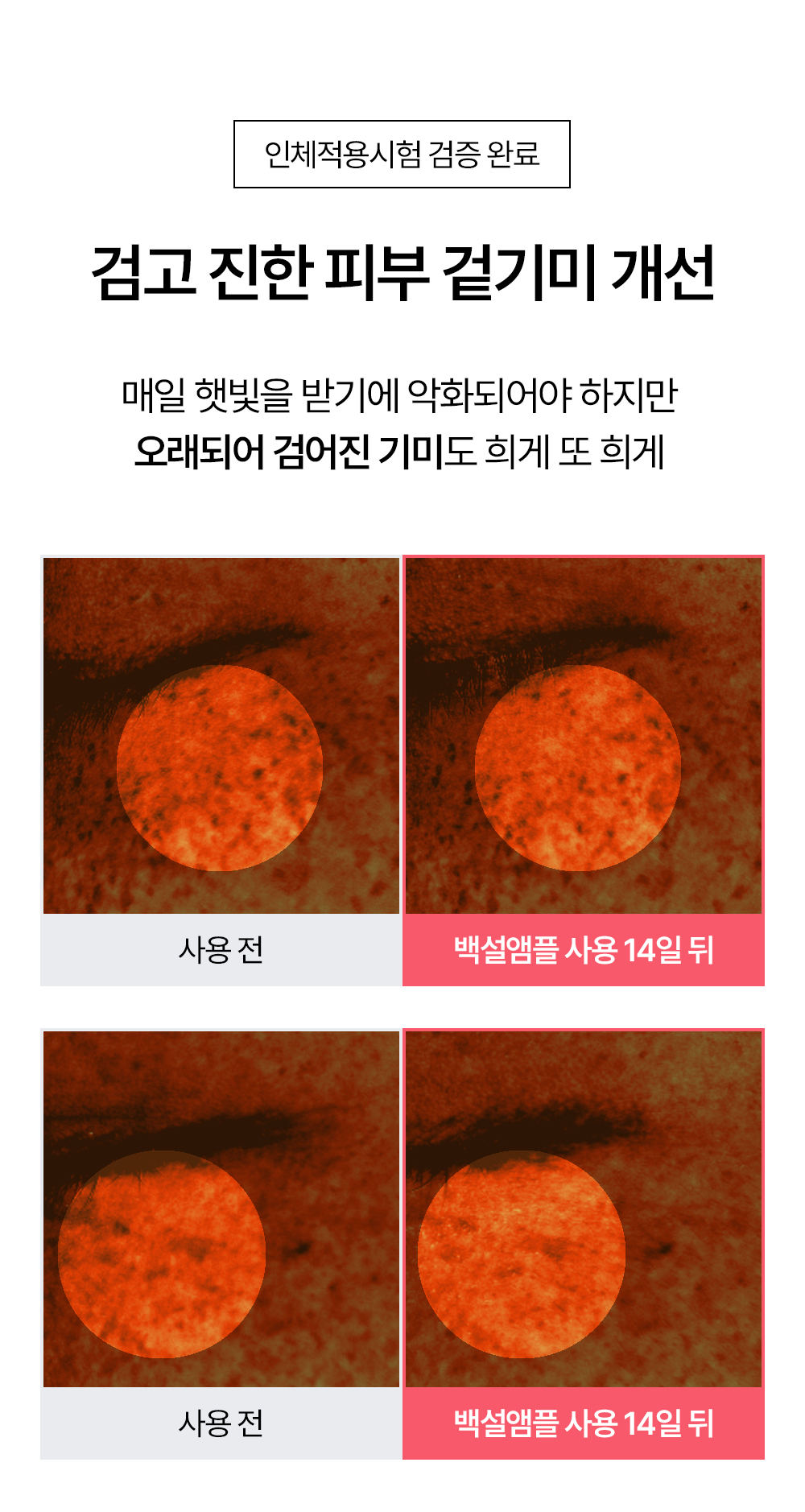 빗결 백설 앰플