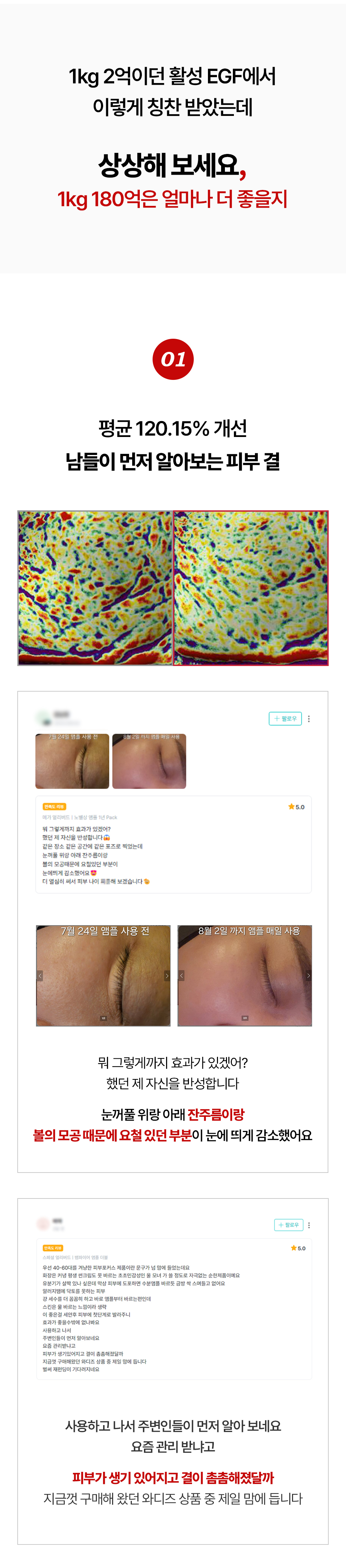 뱀파이어 EGF 앰플