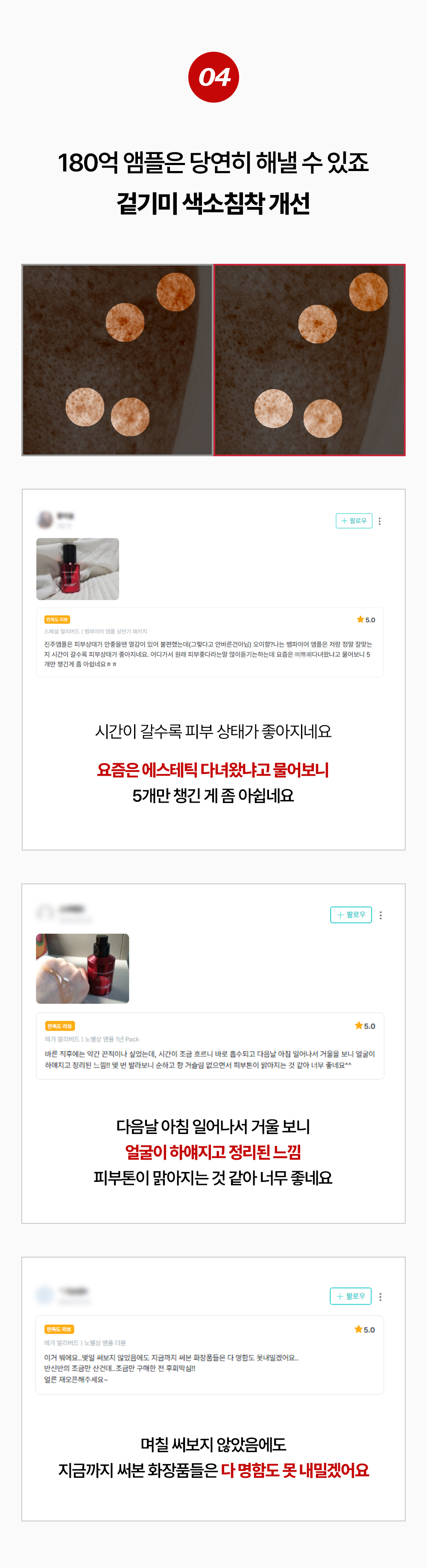 뱀파이어 EGF 앰플