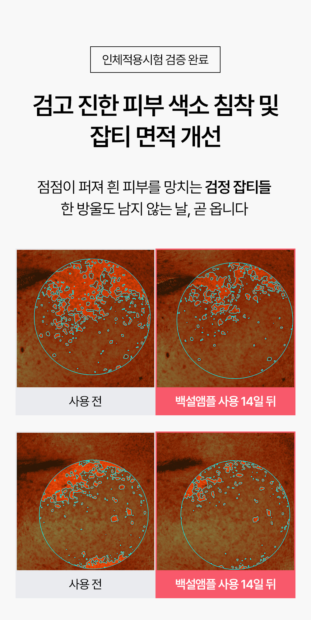 빗결 백설 앰플