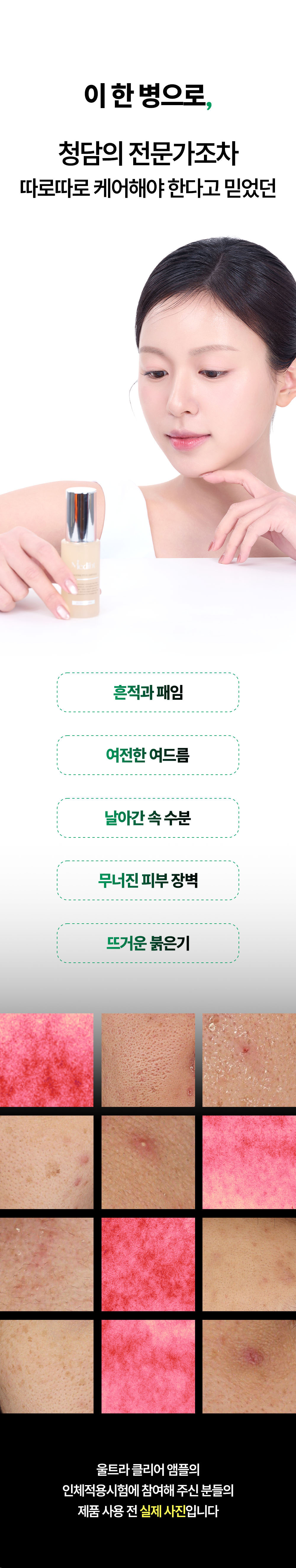 토타덤 피톡스 앰플
