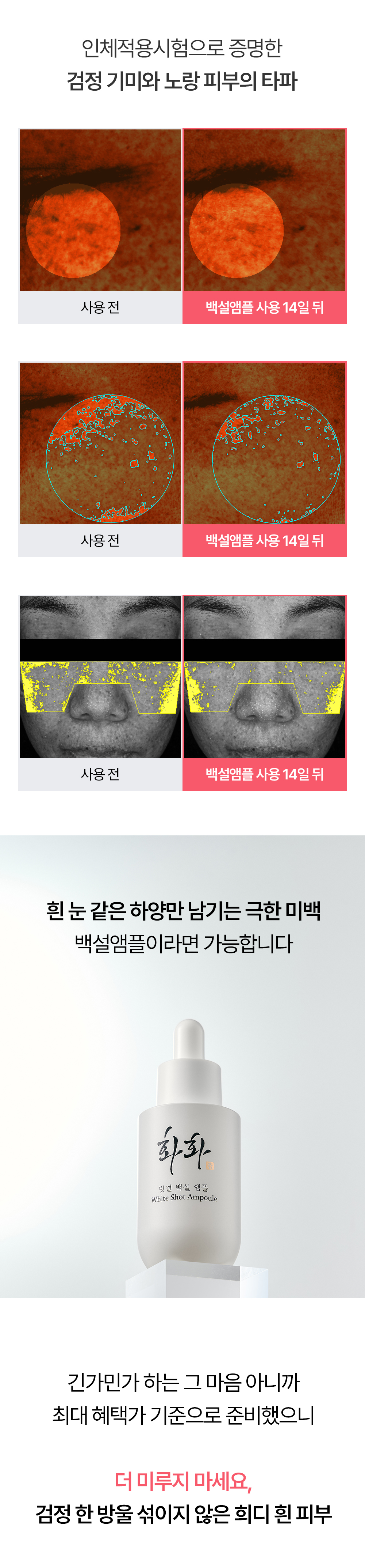 빗결 백설 앰플