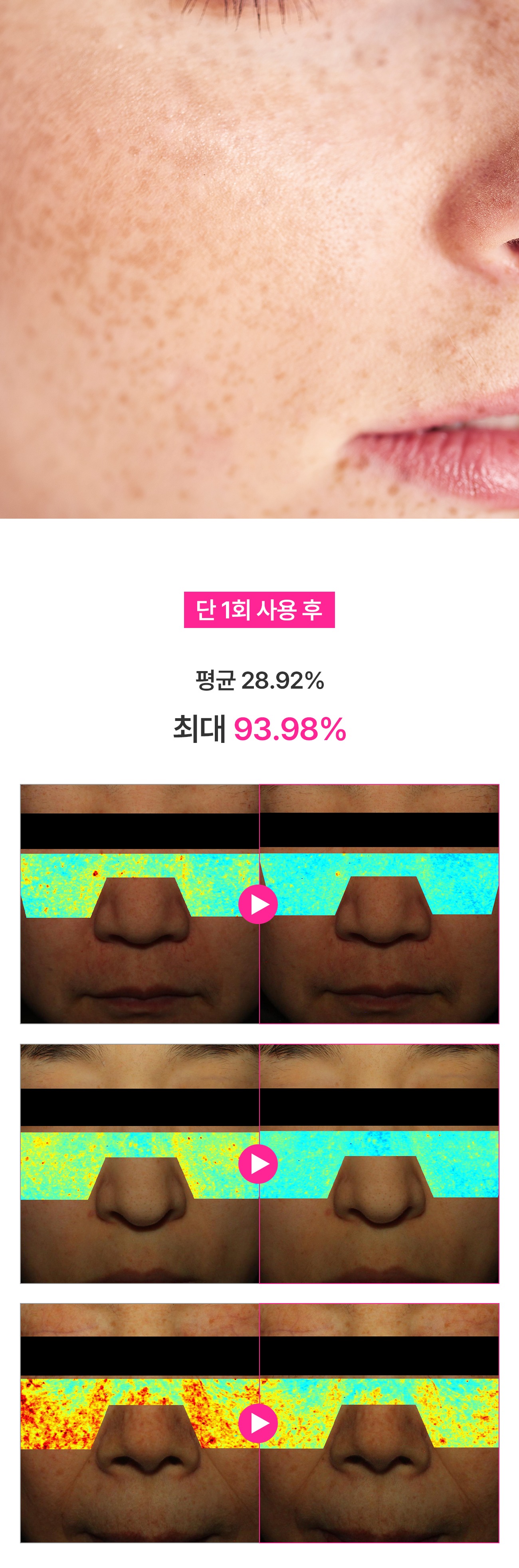멜라노 하이드라 모공 크림